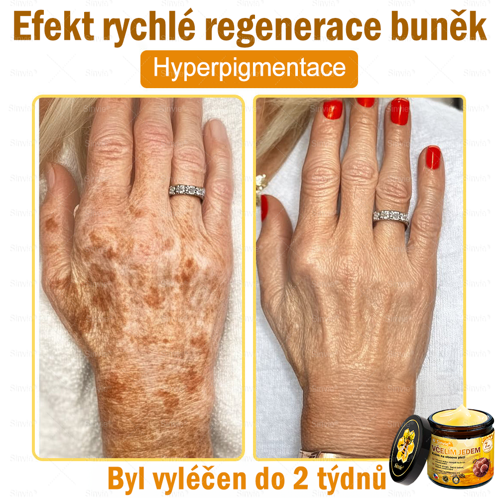 Sinvie® Krém na obnovu pleti s včelím jedem | 50 ml | Doporučeno Českou dermatovenerologickou společností