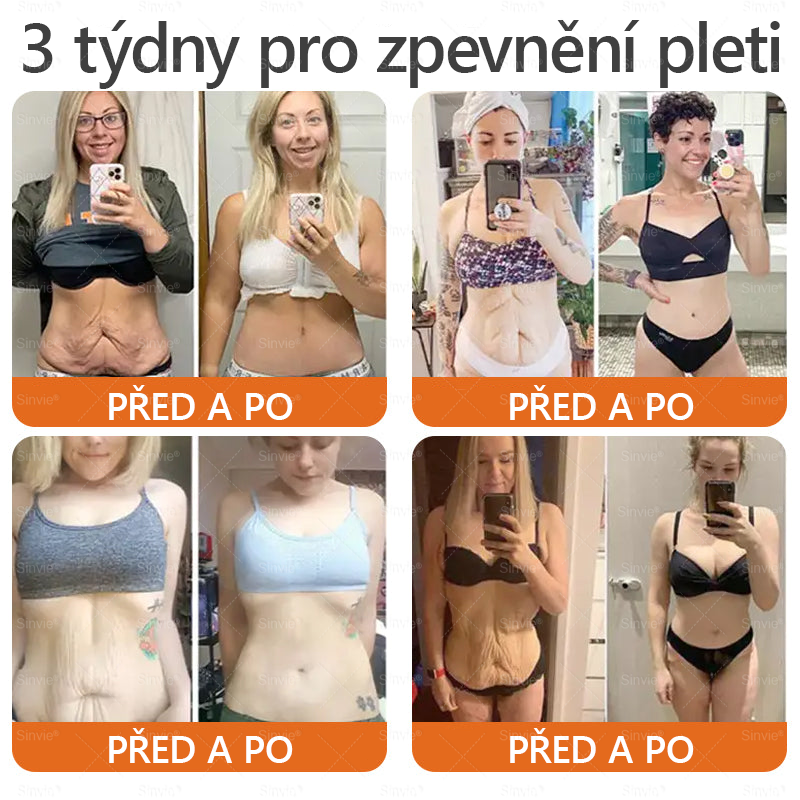 Sinvie® Krém na obnovu pleti s včelím jedem|Doporučeno dermatologem|50ml