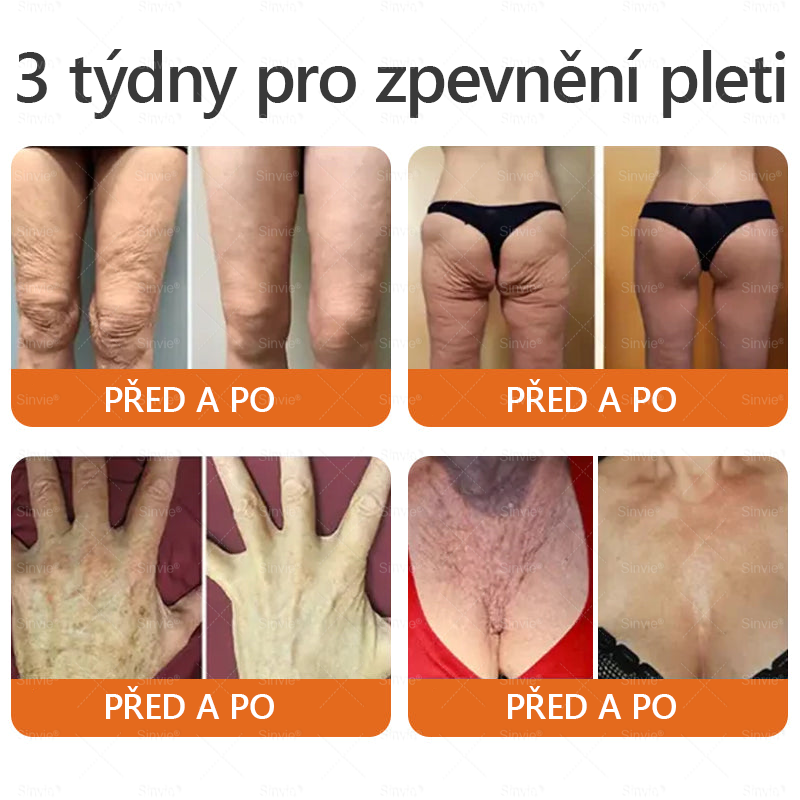 Sinvie® Krém na obnovu pleti s včelím jedem|Doporučeno dermatologem|50ml