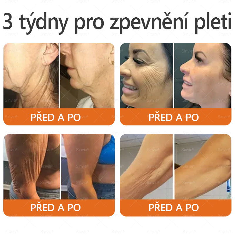 Sinvie® Krém na obnovu pleti s včelím jedem|Doporučeno dermatologem|50ml