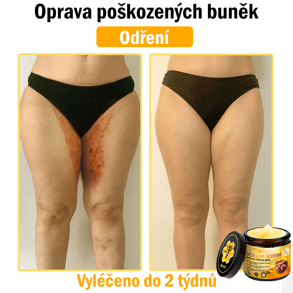 Sinvie® Krém na obnovu pleti s včelím jedem | 50 ml | Doporučeno Českou dermatovenerologickou společností