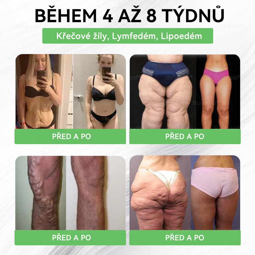 BuildLeaf® GLP-1 8-v-1 Fit & Vital Řešení (Jednou denně, viditelné změny za 7 dní) - Obezita, kardiovaskulární zdraví, cukrovka, spánková apnoe, zdraví střev, problémy se klouby a další.
