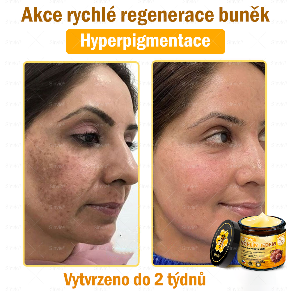 Sinvie® Krém na obnovu pleti s včelím jedem|Doporučeno dermatologem|50ml