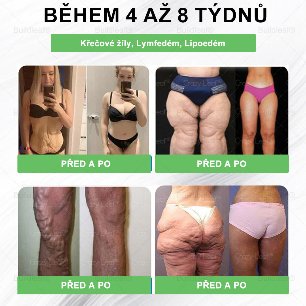 BuildLeaf® GLP-1 6-v-1 Health Solution Perorální tekutina (🧬Pouze jednou denně, viditelné změny za 7 dní) ✅ Pro obezitu, kardiovaskulární onemocnění, cukrovku, spánkovou apnoe, zdraví střev, problémy s klouby a další