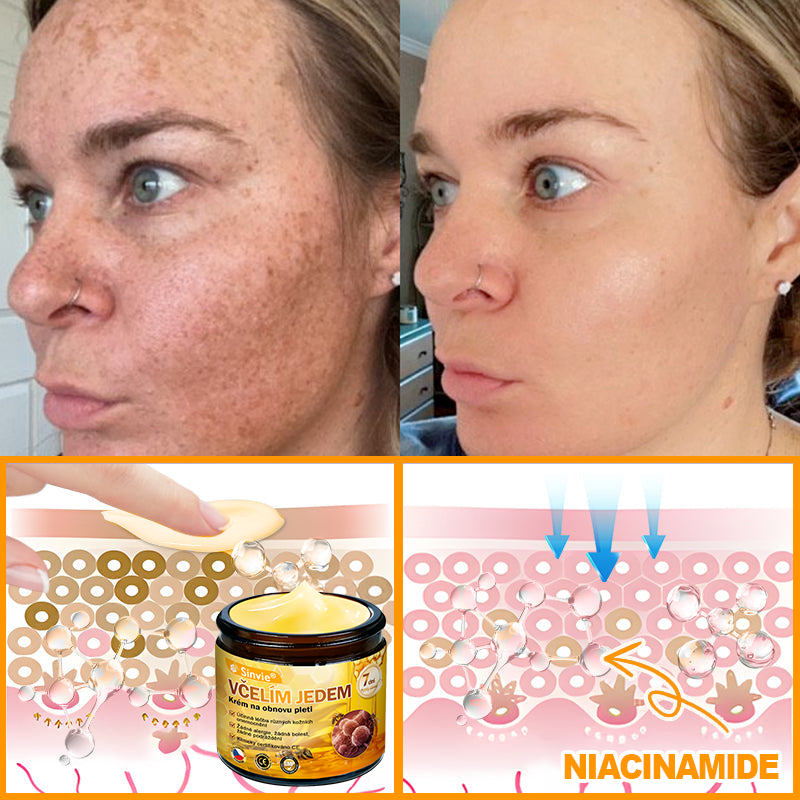 Sinvie® Krém na obnovu pleti s včelím jedem | 50 ml | Doporučeno Českou dermatovenerologickou společností