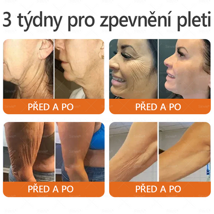 Sinvie® Krém na obnovu pleti s včelím jedem|Doporučeno dermatologem|50ml