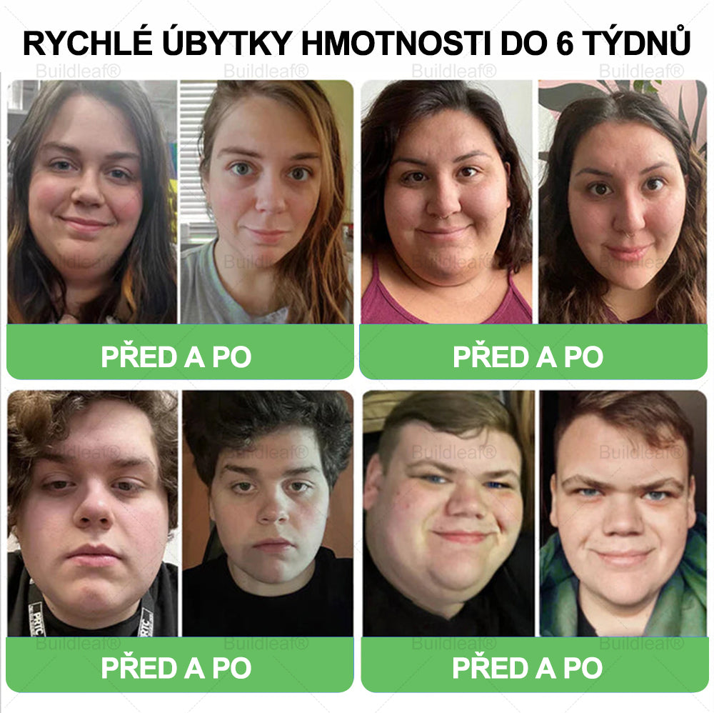 BuildLeaf® GLP-1 6-v-1 Health Solution Perorální tekutina (🧬Pouze jednou denně, viditelné změny za 7 dní) ✅ Pro obezitu, kardiovaskulární onemocnění, cukrovku, spánkovou apnoe, zdraví střev, problémy s klouby a další