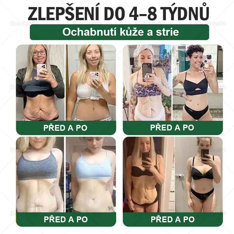 BuildLeaf® GLP-1 6-v-1 Health Solution Perorální tekutina (🧬Pouze jednou denně, viditelné změny za 7 dní) ✅ Pro obezitu, kardiovaskulární onemocnění, cukrovku, spánkovou apnoe, zdraví střev, problémy s klouby a další