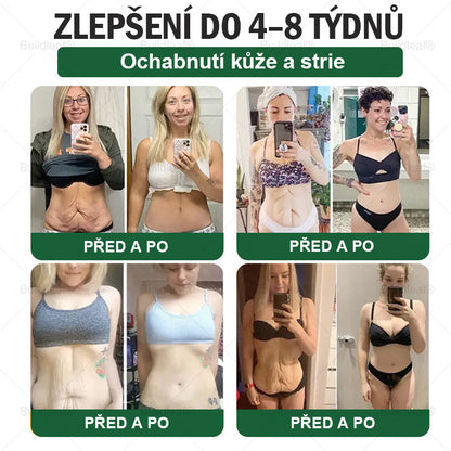 BuildLeaf® GLP-1 6-v-1 Health Solution Perorální tekutina (🧬Pouze jednou denně, viditelné změny za 7 dní) ✅ Pro obezitu, kardiovaskulární onemocnění, cukrovku, spánkovou apnoe, zdraví střev, problémy s klouby a další